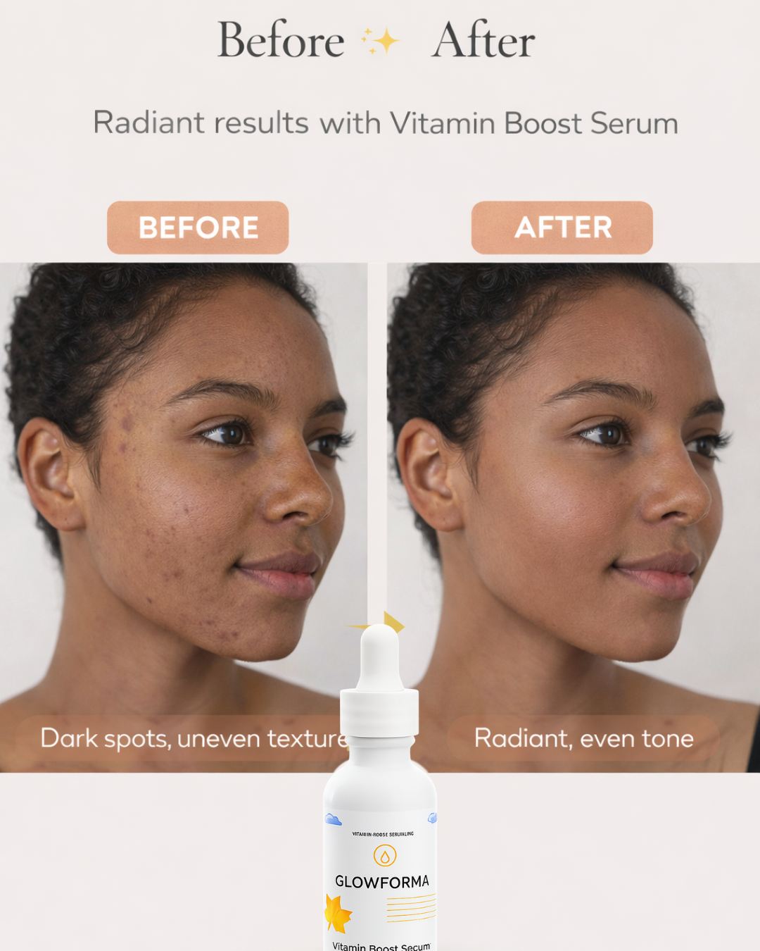 Vitamin Boost Serum | Radiant Glow – 1oz